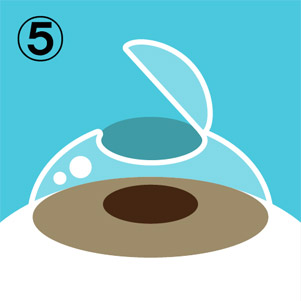 レーシック手術フロー図5